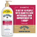 Gold Bond Diabetics' Dry Skin Relief Body Lotion with Aloe, 21 oz.